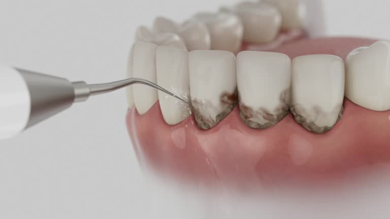 Reliable Dental Implants contractor in Raceland, LA by Smile Center Dentistry